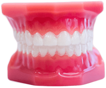 clear aligners on plastic model
